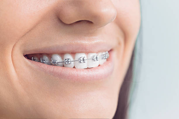 Best Full Mouth Reconstruction  in Takoma Park, MD